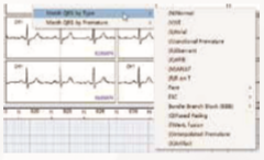ENDO ECG Holter Monitoring EI.HM