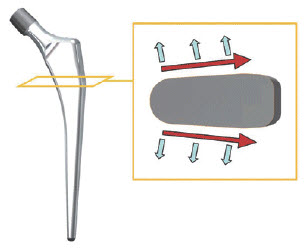 Corentec Bencox ID Cemented Stem