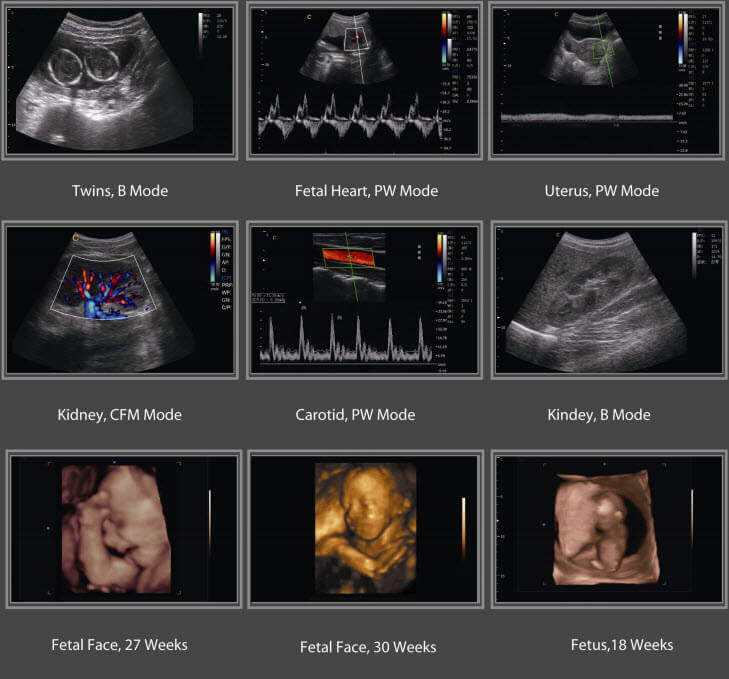 ENDO EI.USG4D, Digital Color Ultrasound Diagnostic System