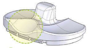 Corentec Lospa Knee System