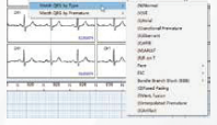 ENDO ECG Holter Monitoring EI.HM12Ch