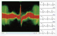 ENDO ECG Holter Monitoring EI.HM12Ch