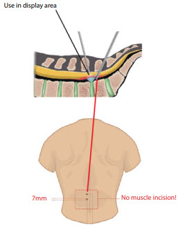 Universal Retractor